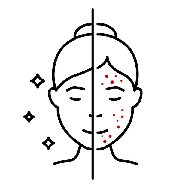 Skin Problems