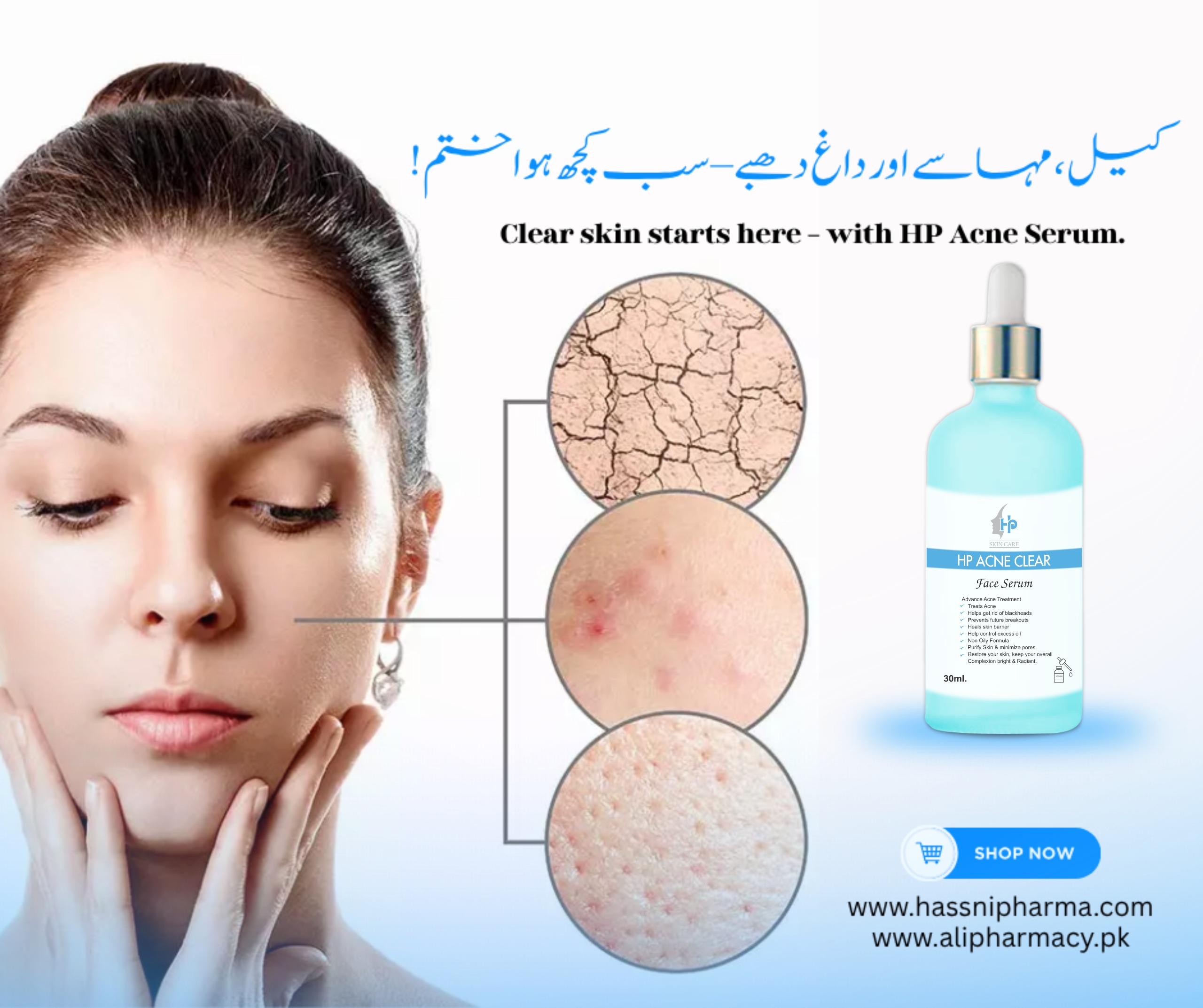 HP Acne Clear Serum – The Advanced Solution for Clear, Healthy Skin