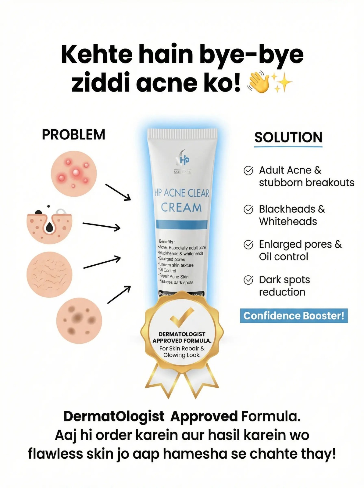 HP Acne Clear Cream 30g
